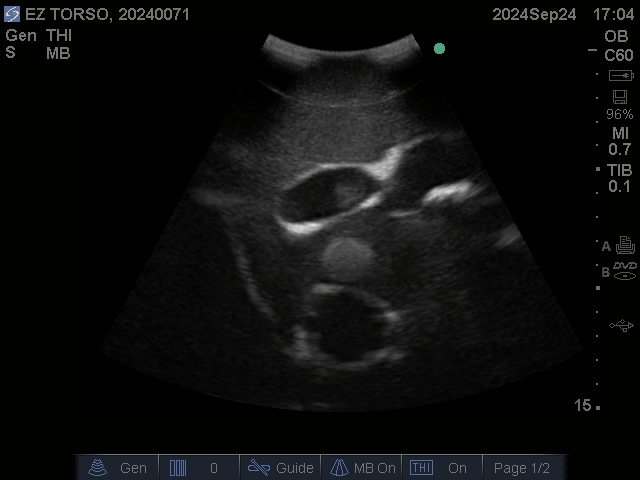 Ultrasound Scans