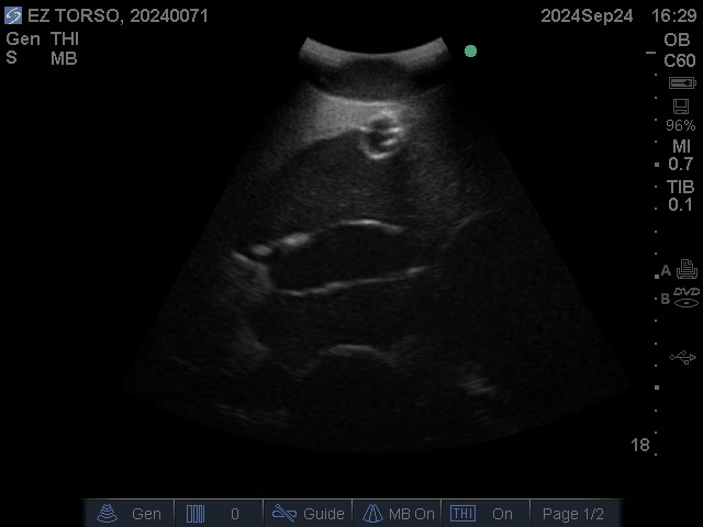 Ultrasound Scans