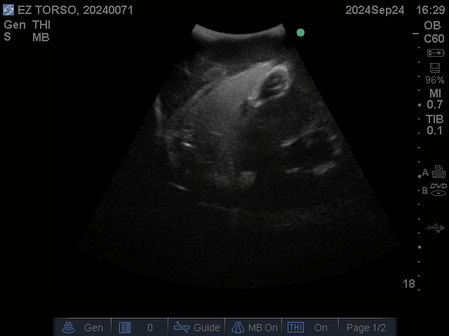 Ultrasound Scans