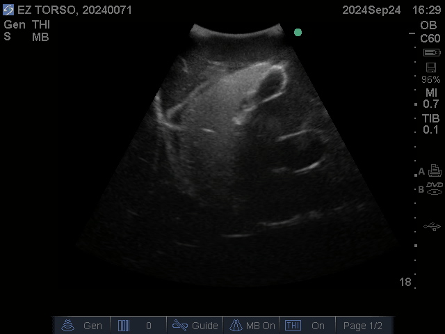 Ultrasound Scans