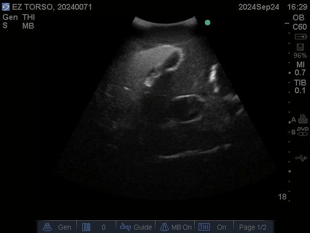 Ultrasound Scans