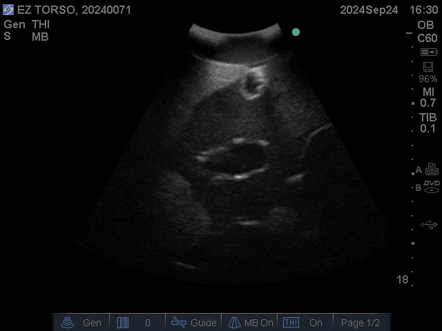 Ultrasound Scans