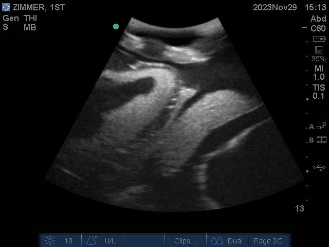 Ultrasound Scans