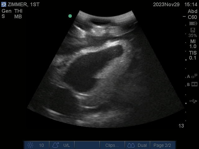 Ultrasound Scans