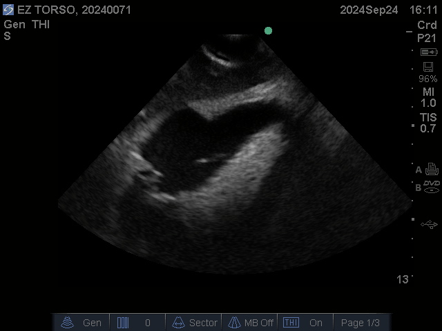 Ultrasound Scans