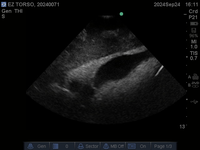 Ultrasound Scans