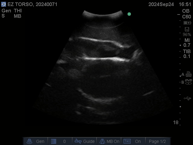 Ultrasound Scans