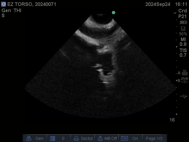 Ultrasound Scans