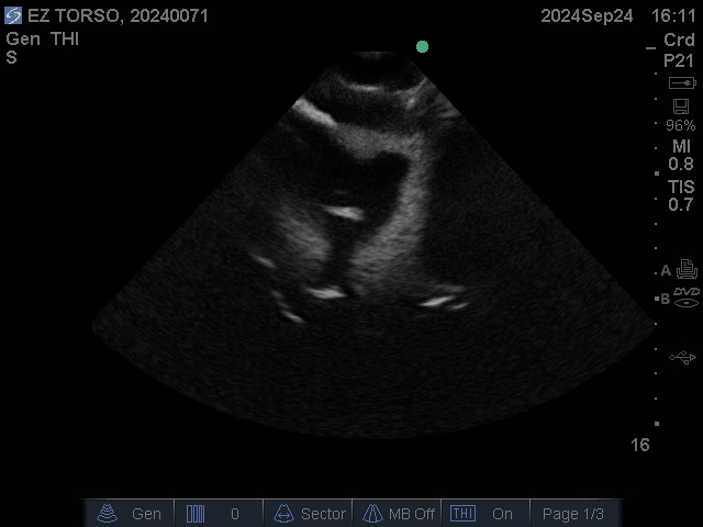 Ultrasound Scans