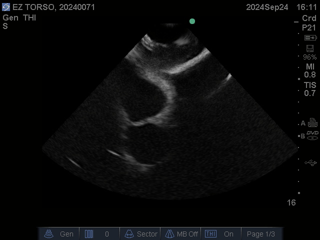 Ultrasound Scans
