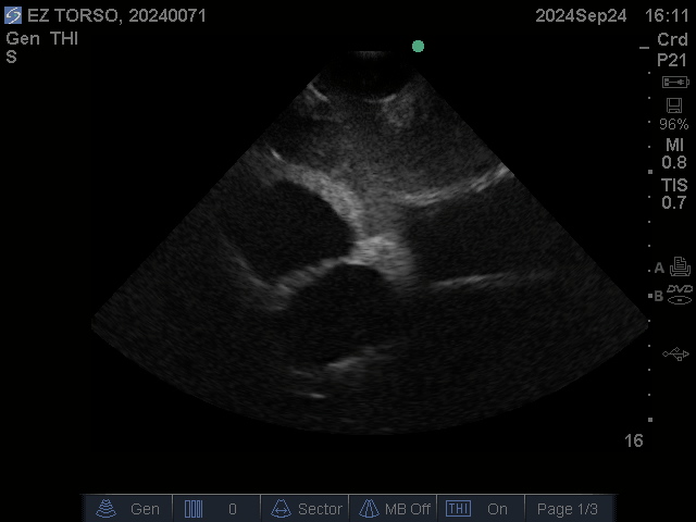 Ultrasound Scans