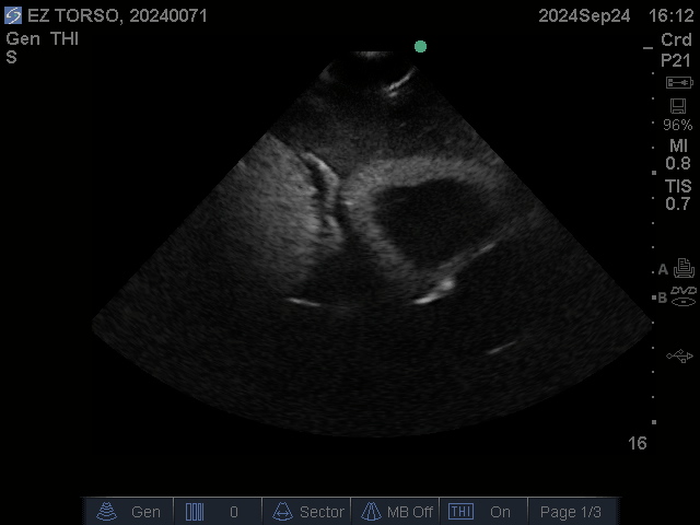 Ultrasound Scans