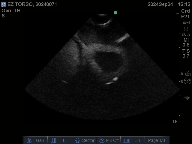 Ultrasound Scans