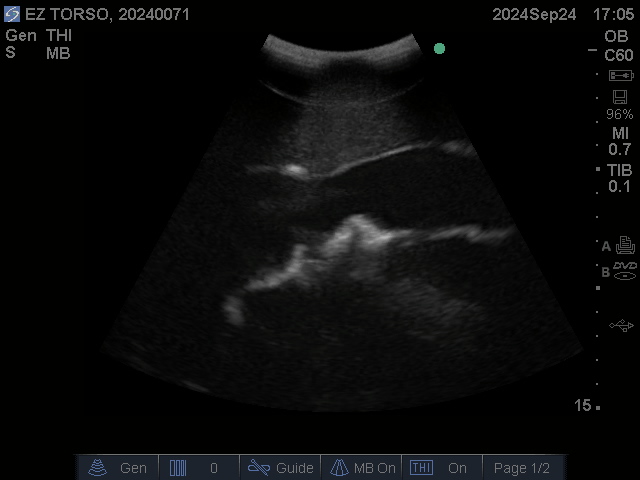 Ultrasound Scans