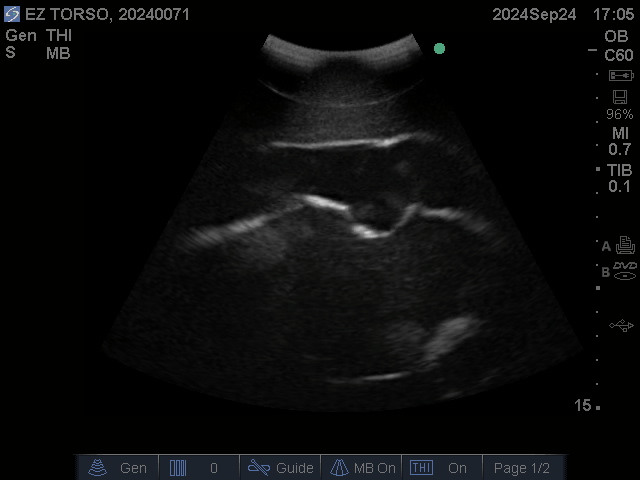Ultrasound Scans
