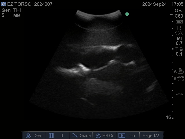 Ultrasound Scans