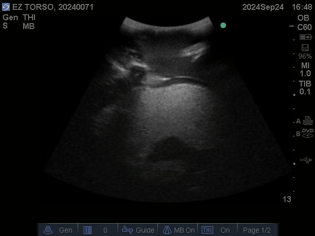 Ultrasound Scans