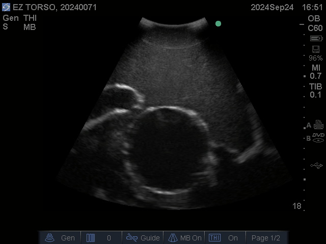Ultrasound Scans