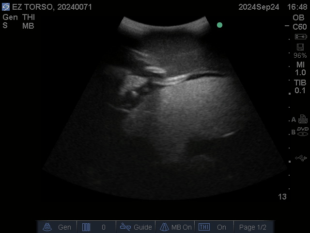 Ultrasound Scans