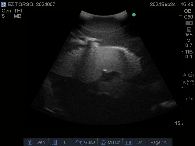 Ultrasound Scans