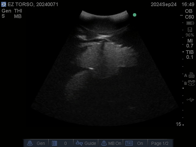 Ultrasound Scans