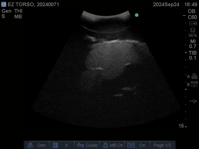 Ultrasound Scans