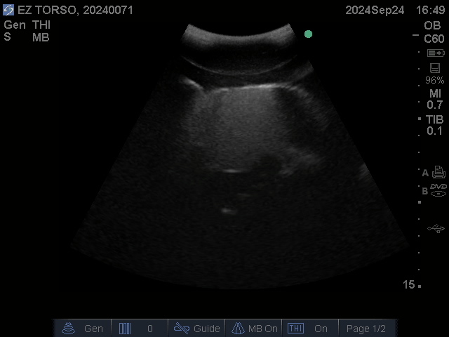 Ultrasound Scans