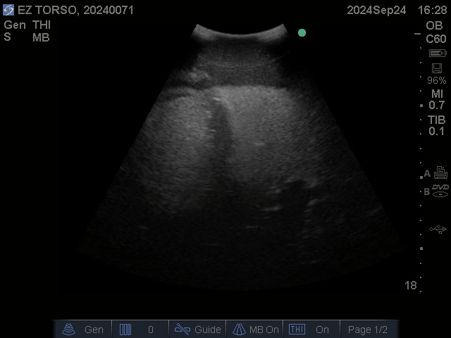 Ultrasound Scans