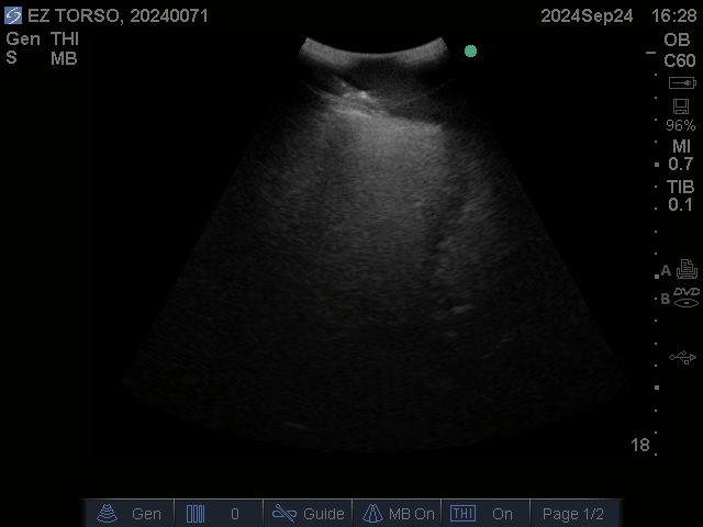 Ultrasound Scans