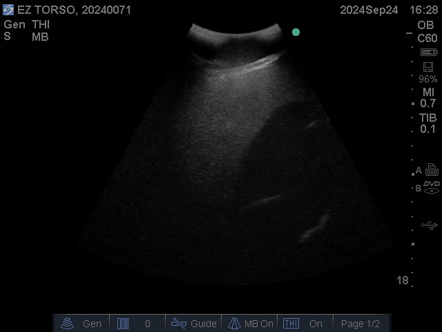 Ultrasound Scans