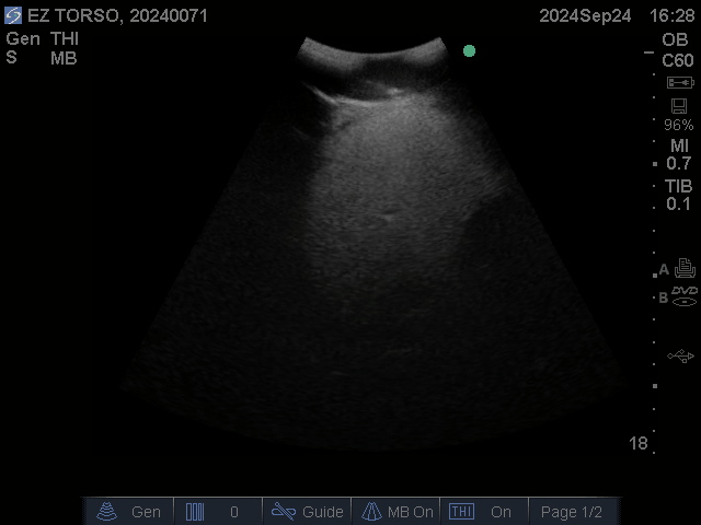 Ultrasound Scans