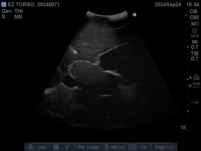 Ultrasound Scans