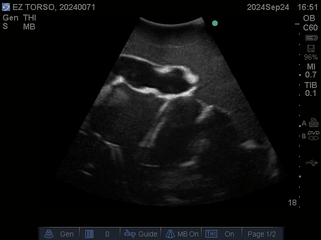 Ultrasound Scans