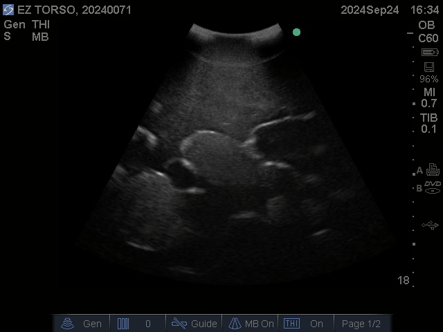 Ultrasound Scans
