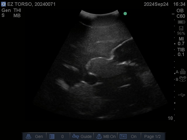 Ultrasound Scans