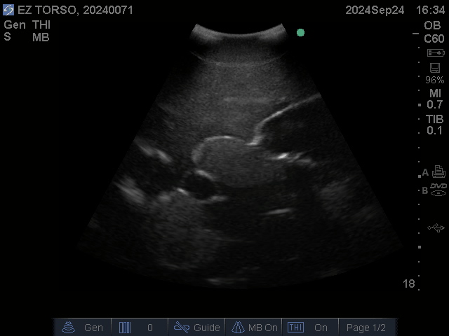 Ultrasound Scans