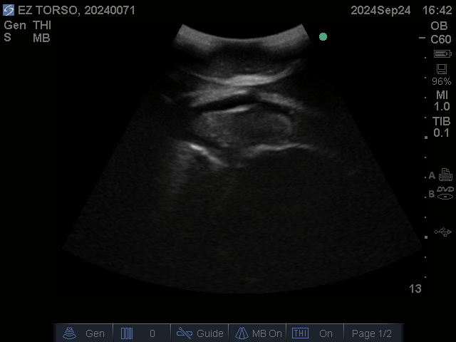 Ultrasound Scans