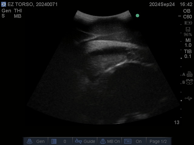 Ultrasound Scans