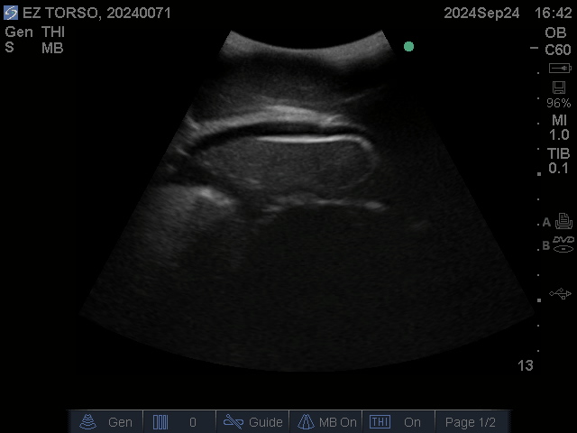 Ultrasound Scans