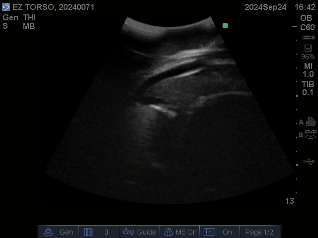 Ultrasound Scans