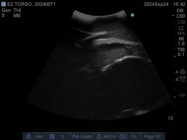Ultrasound Scans