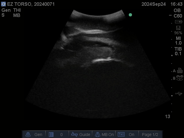 Ultrasound Scans