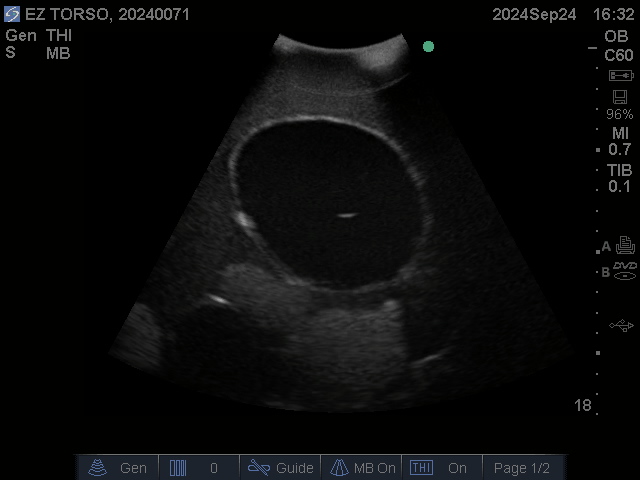 Ultrasound Scans