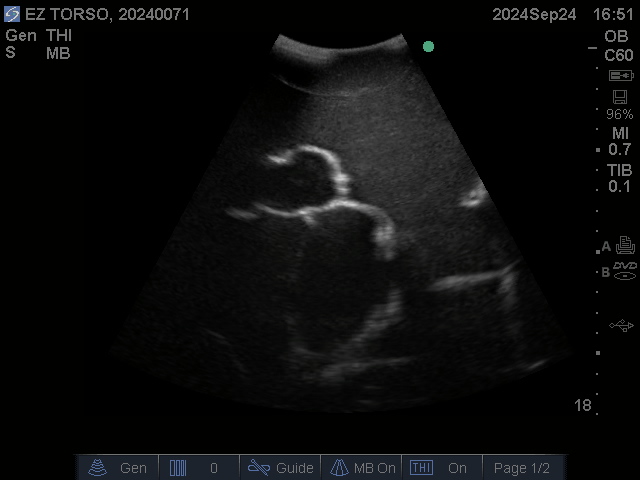 Ultrasound Scans