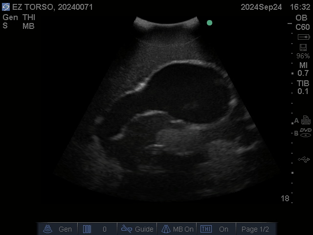 Ultrasound Scans