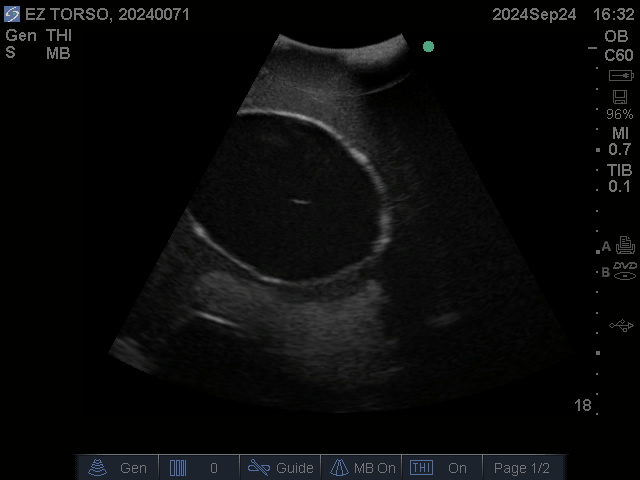 Ultrasound Scans