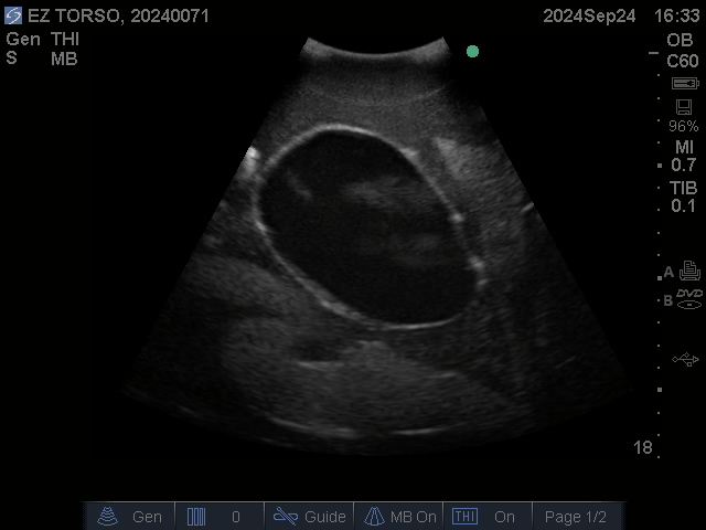 Ultrasound Scans