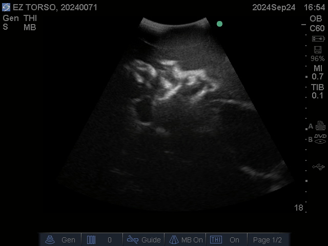 Ultrasound Scans