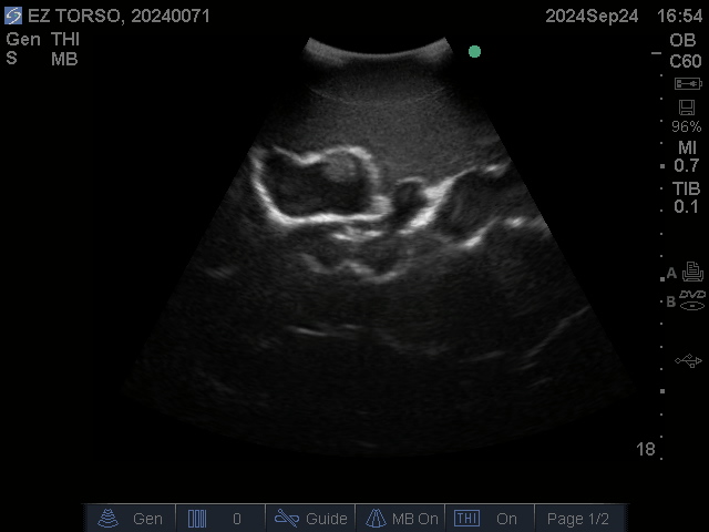 Ultrasound Scans