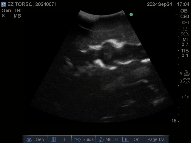 Ultrasound Scans